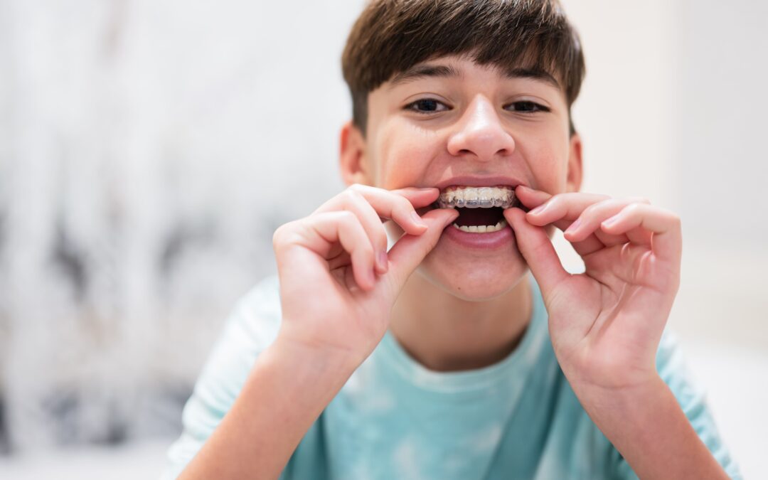 Ortodoncia Cerámica: Una Opción Estética para la Corrección Dental